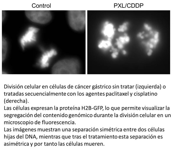 División celular en células de cáncer gástrico