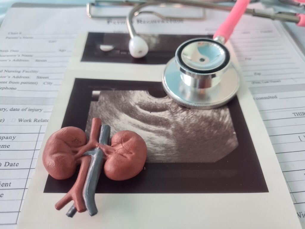 Resultados de una ecografía renal: Imagen de ultrasonido de un riñón junto a un estetoscopio y un modelo anatómico de riñón. Diagnóstico de enfermedades renales.