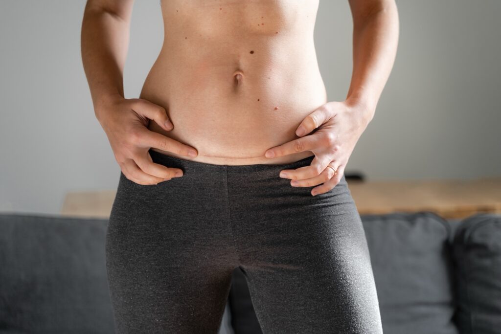 Histerectomía abdominal: tipos, procedimiento y recuperación