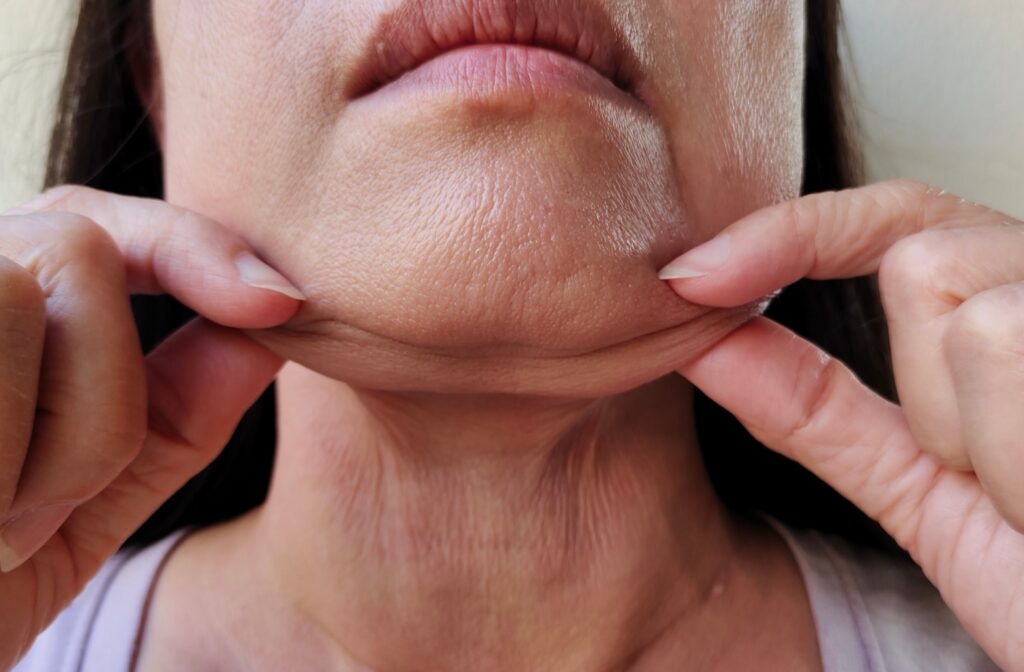 Liposuccion o lifting cual es mejor imagen3