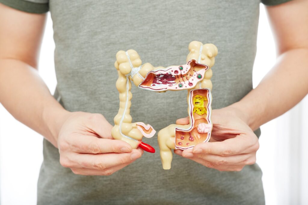 Colonoscopia utilidad imagen3