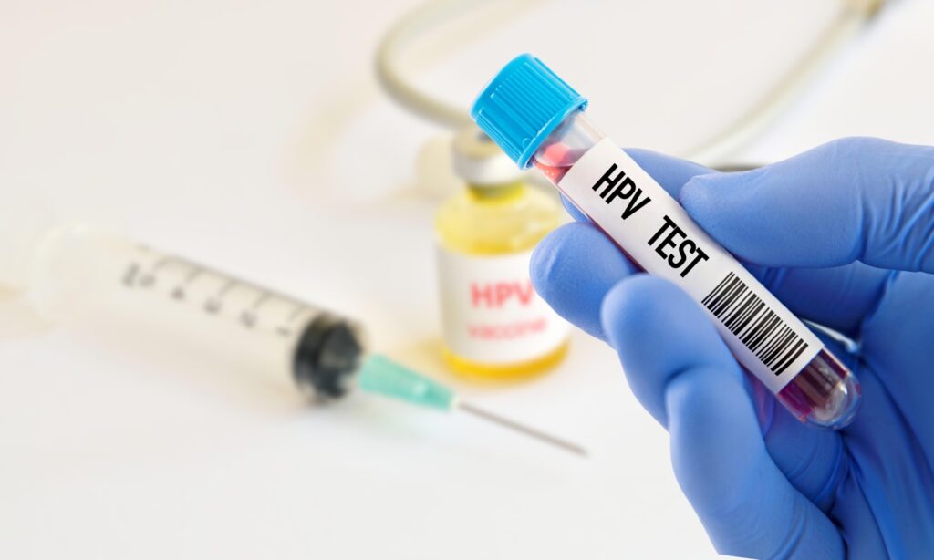 ¿Cómo se realizan las pruebas para detectar el virus del papiloma humano?