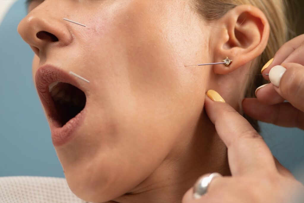 Información parálisis facial imagen3