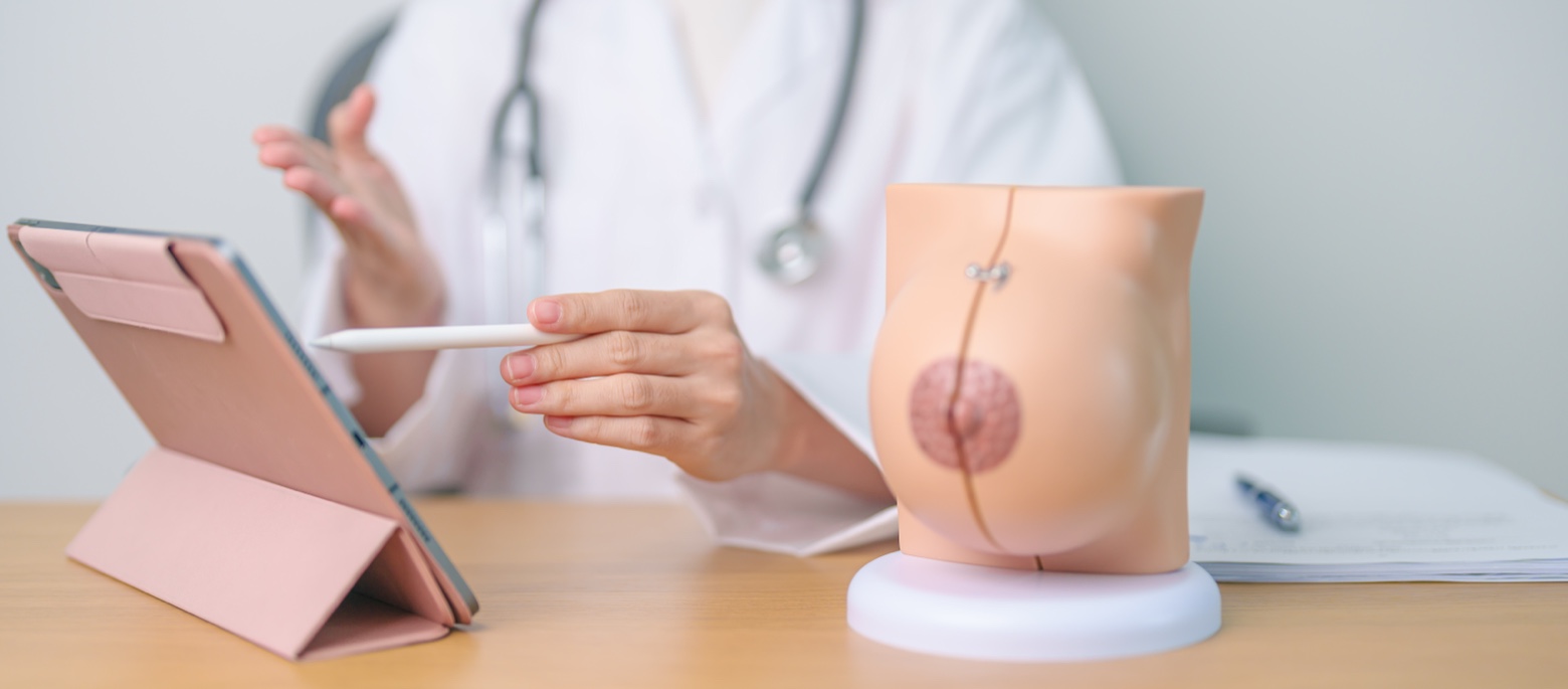 Imagen para: ¿Qué es la ectasia ductal? Conoce sus síntomas principales y su tratamiento