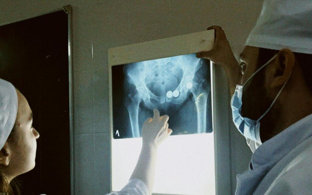 Imagen de fractura de cadera en radiografía