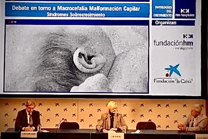 Imagen para: Las macrocefaleas, diagnóstico y calidad de vida