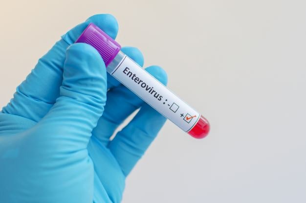 Imagen para: ¿Qué sabes sobre enterovirus?