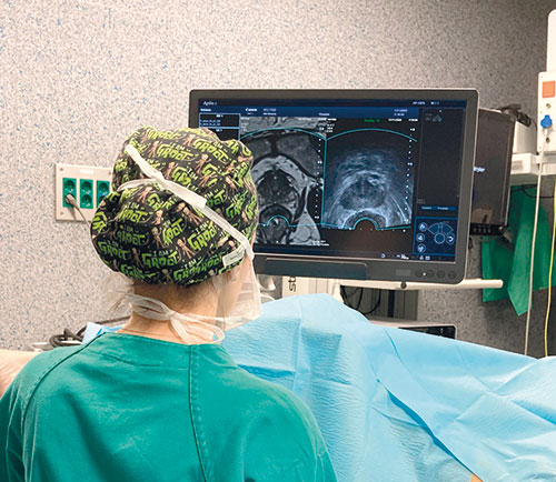 Imagen para: La biopsia de fusión practicada a pacientes con sospecha alta de cáncer de próstata duplica en eficacia diagnóstica a la biopsia tradicional