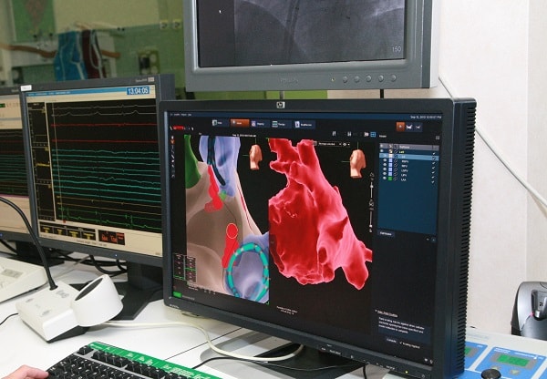 Detección precoz para combatir el asintomático