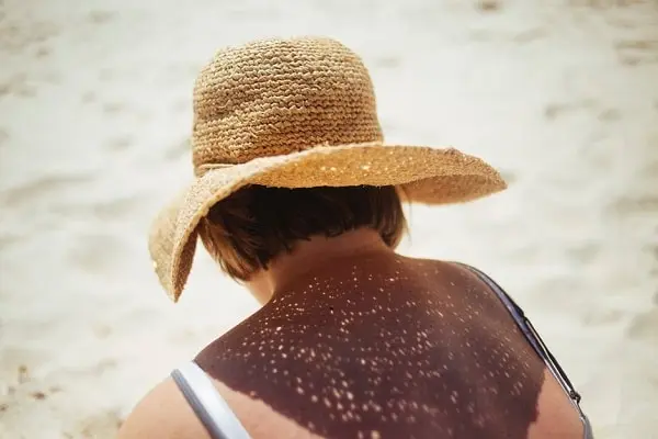 Imagen para: Tiempo de exposición adecuado, fotoprotección y evitar las horas centrales del día claves esenciales para disfrutar del sol en verano y el resto del año
