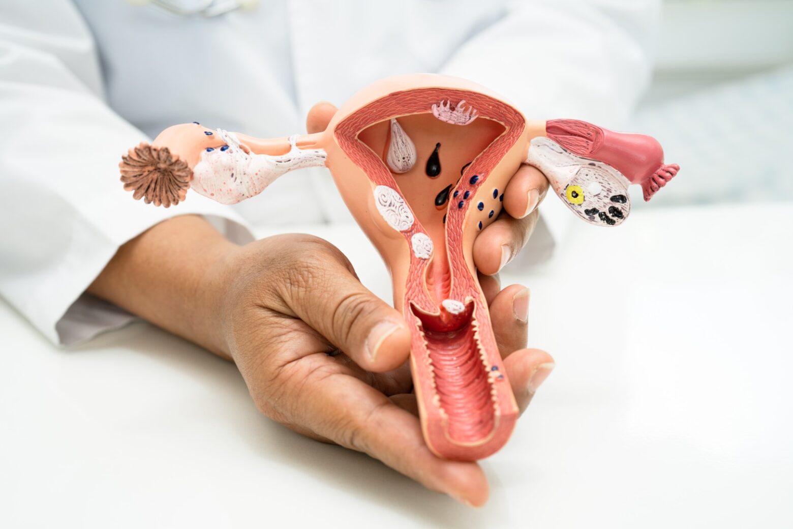 Uterus doctor with anatomy model for study diagno 2025 02 25 08 15 19 utc