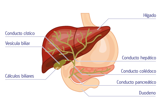 Esquema anatómico para explicar la colelitiasis