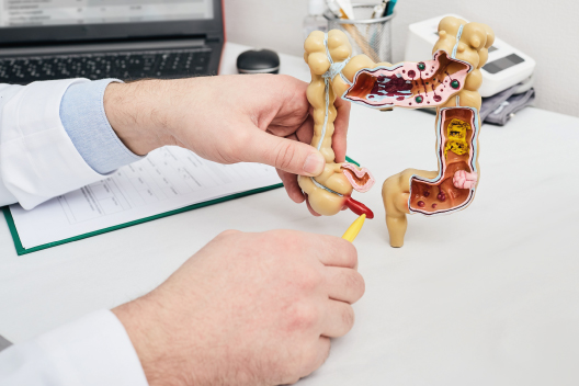 Doctor señalando en una maqueta el apéndice