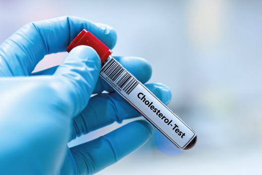 Análisis de sangre para medir el colesterol