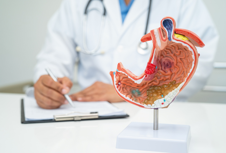 Imagen para: Reflujo gastroesofágico, hernia de hiato y cirugía robótica: cuándo operar y qué beneficios ofrece