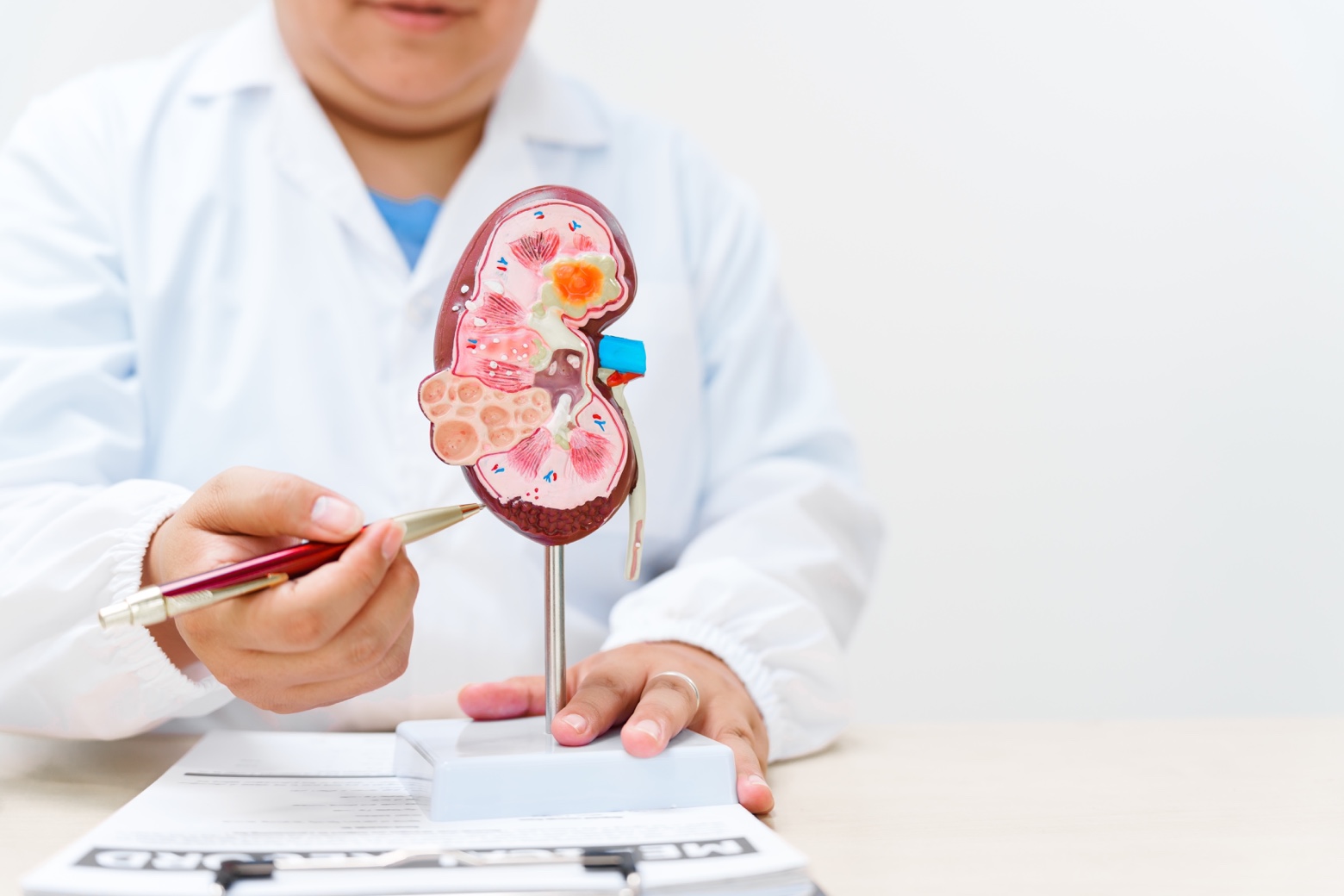 Doctor señalando una patología renal