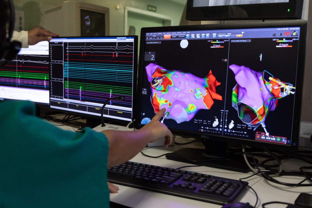 Ablacion fibricular 2560x1707