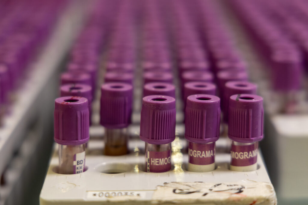 Biopsia liquida 2560x1707