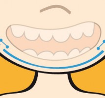 Cirugia maxilofacial