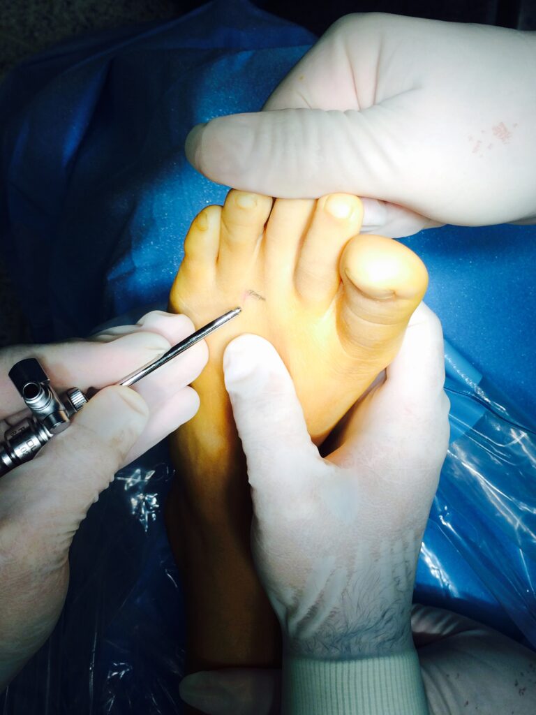 Unidad de artroscopia infantil