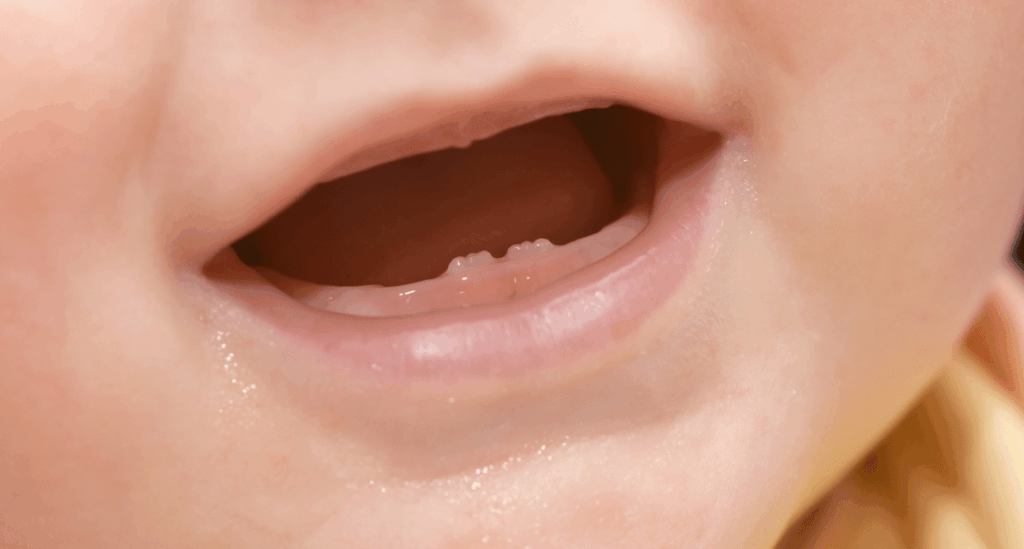 ¿Qué debemos saber sobre los primeros dientes?