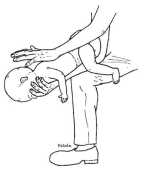 Imagen para: Primeros auxilios y seguridad infantil: Guía Esencial para Padres