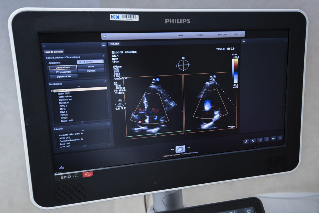 Eco cardio 3d 2560x1707