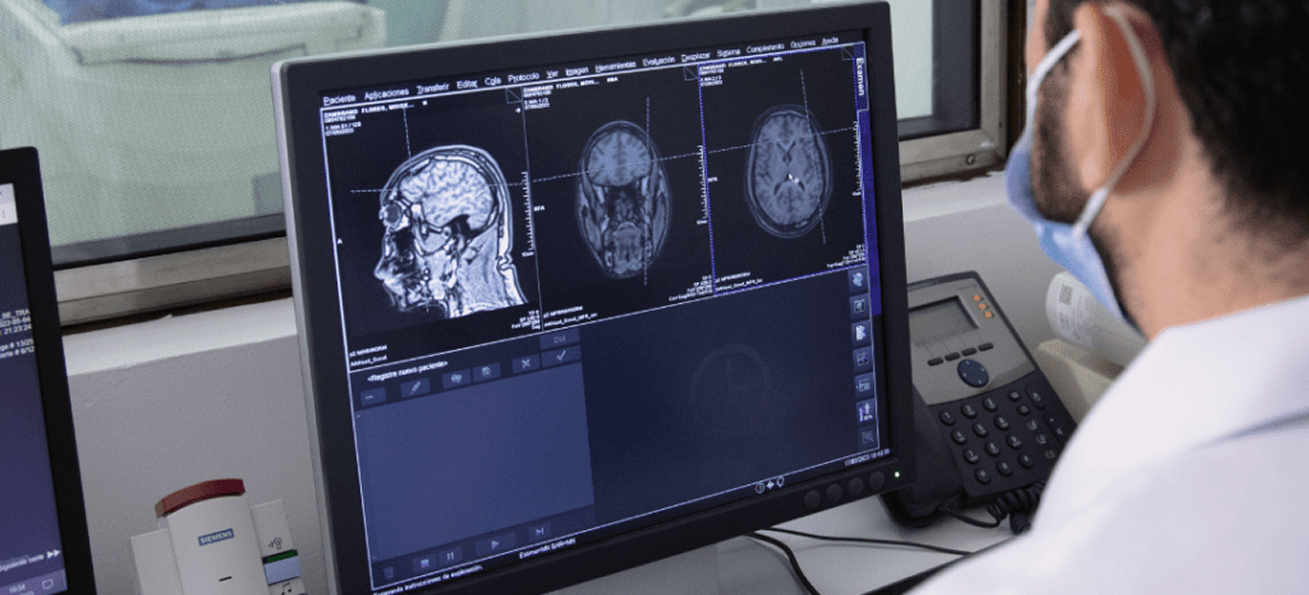 Prevención temprana. Personal sanitario revisando resultados de pruebas cerebrales.
