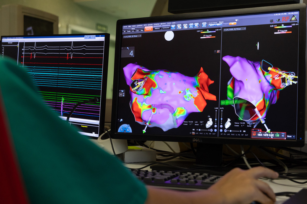 Pruebas cie. Monitor de una pantalla con resultados de una prueba médica.
