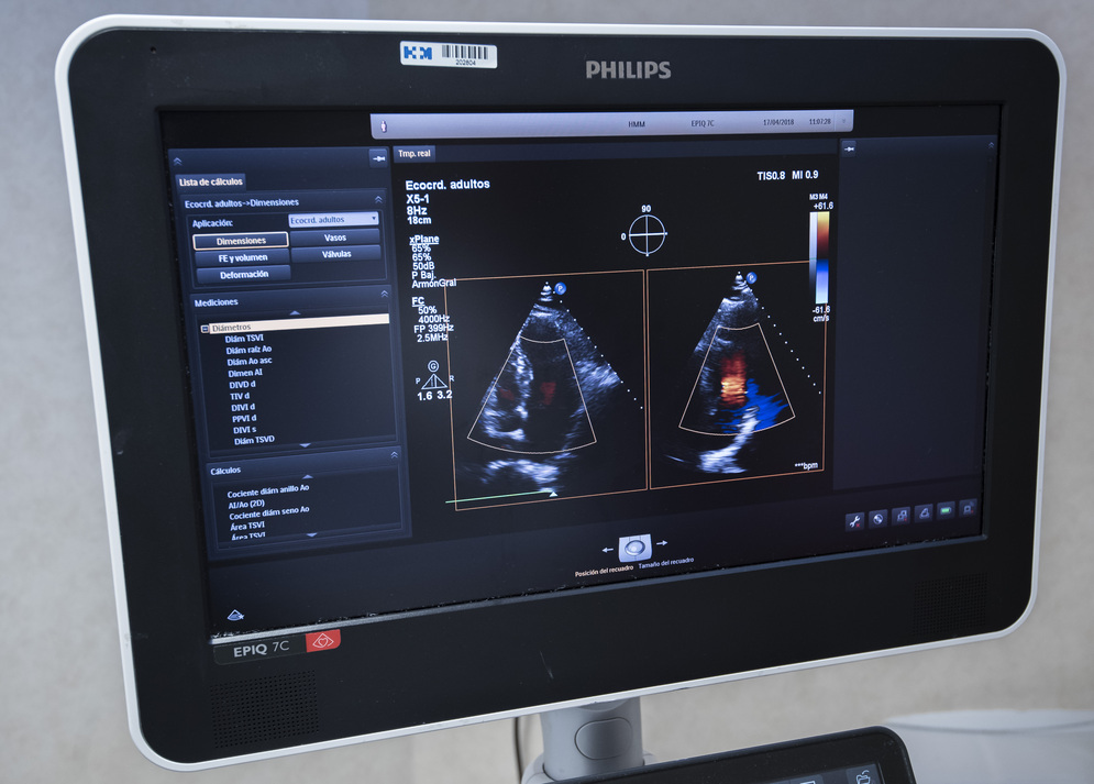 HM Monteprincipe. Monitor de ordenador mostrando resultados de una prueba médica.