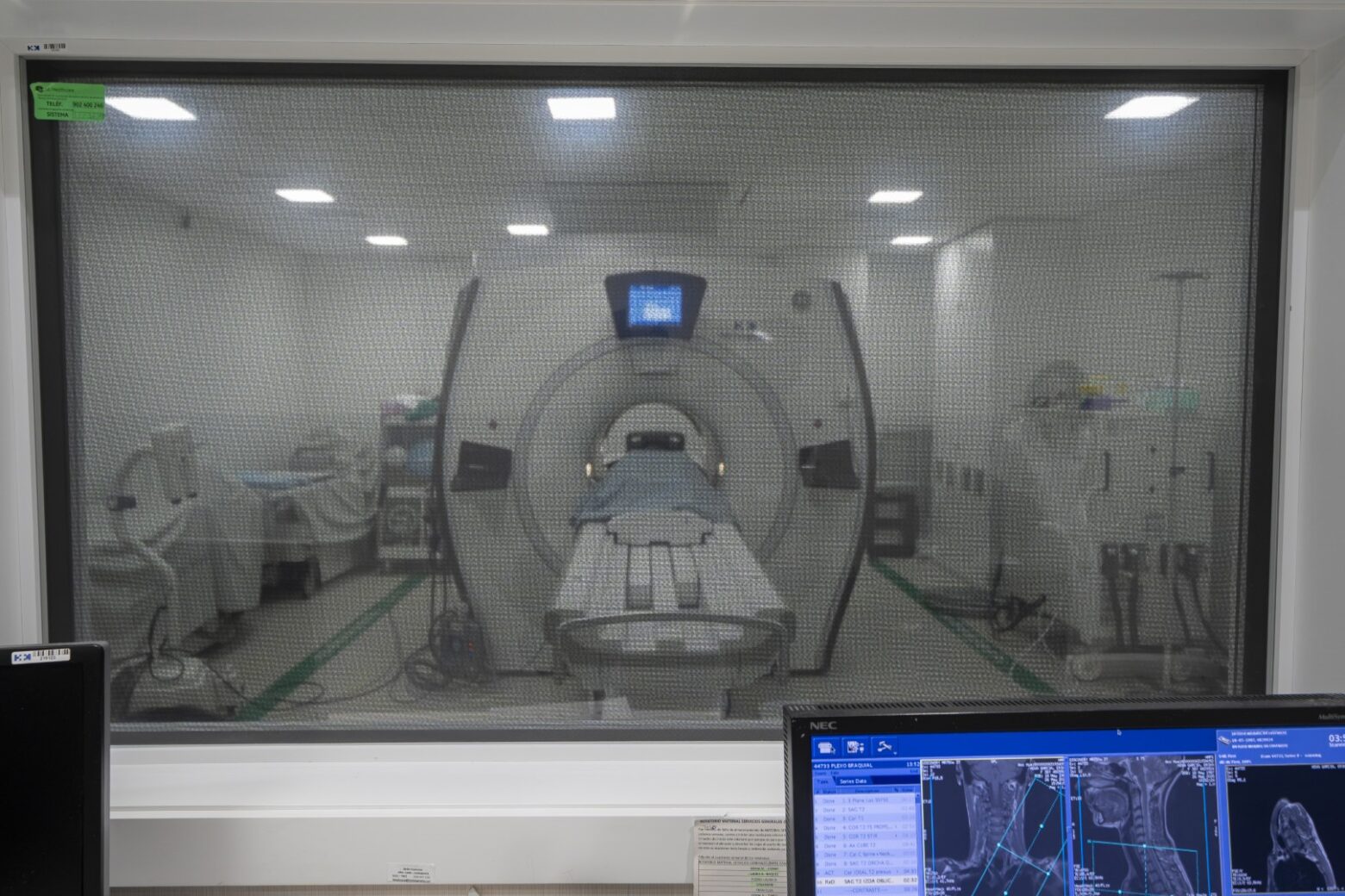 HM Puerta del Sur prueba DBS