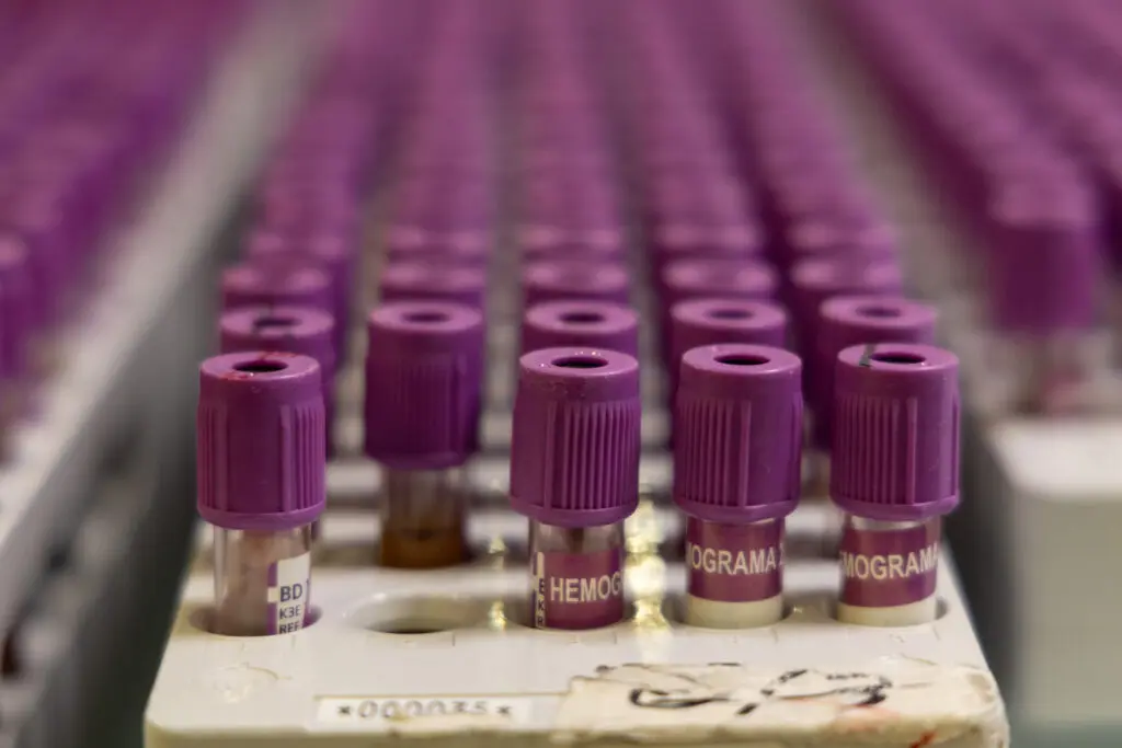 Muestas de una biopsia líquida