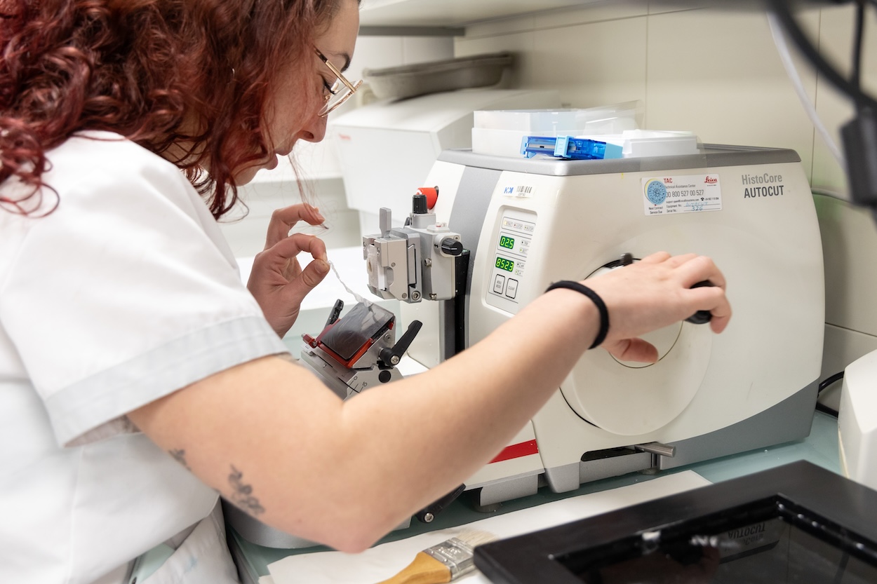 HM Sanchinarro. Personal sanitario usando dianas moleculares.