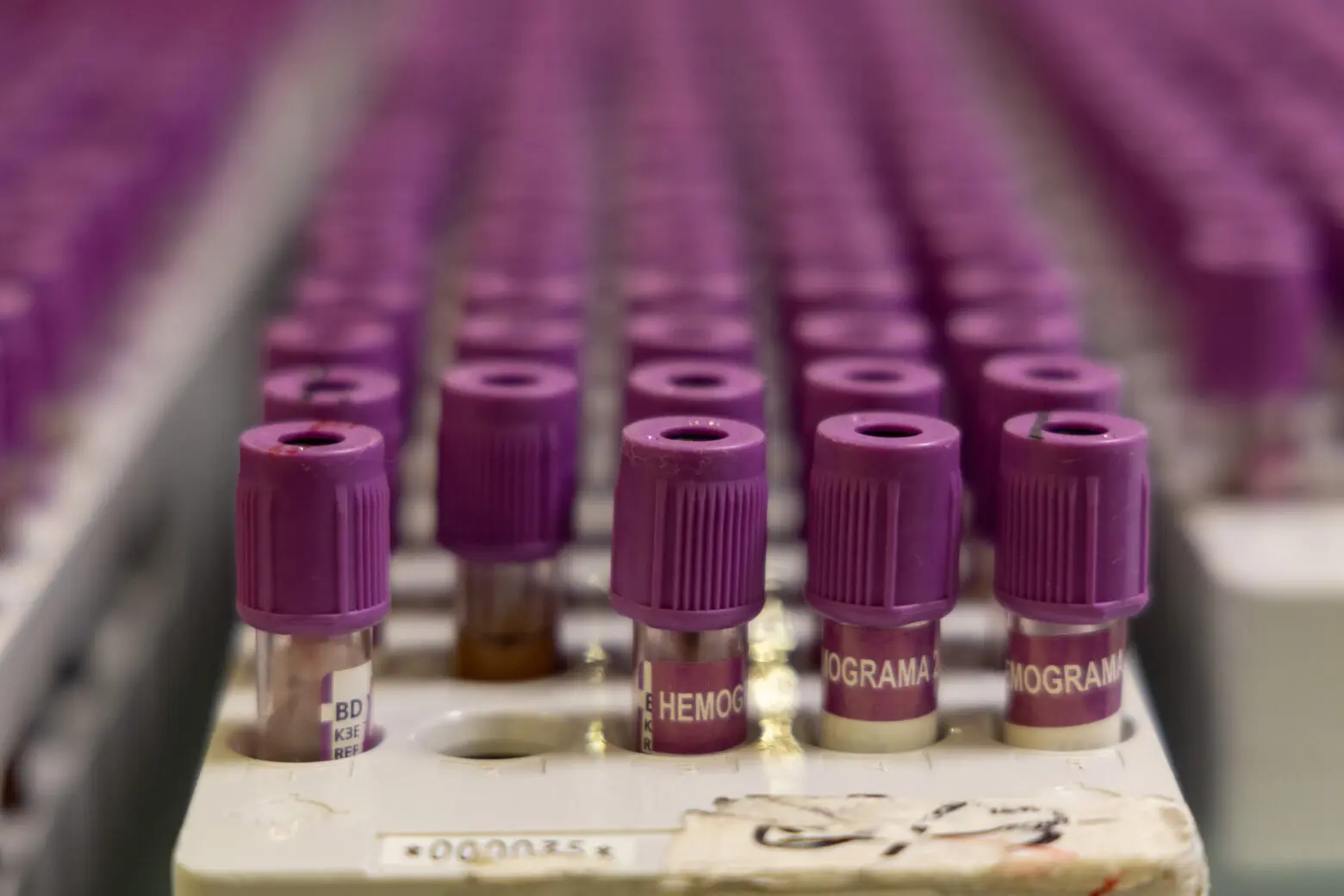 Biopsia liquida 2560x1707